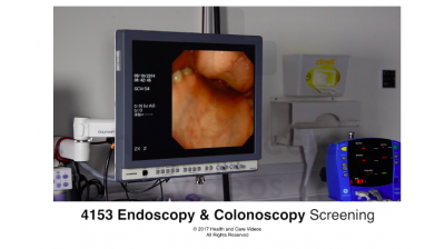 Endoscopy & Colonoscopy - screening Thumbnail