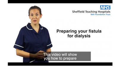 Preparing your fistula for dialysis Thumbnail