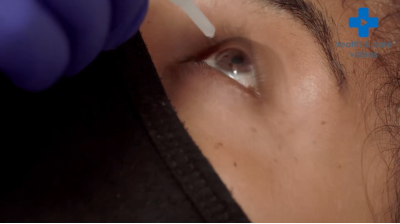 I have been referred for YAG laser capsulotomy, what does this mean? Thumbnail
