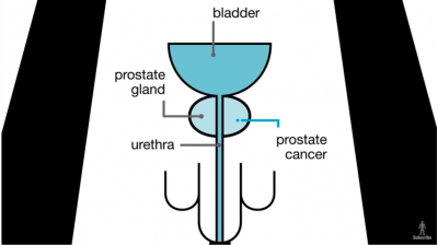 What is the prostate? Thumbnail