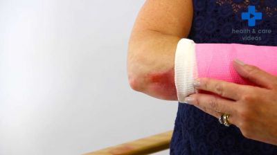 How to prevent a pressure ulcer when you have a cast Thumbnail
