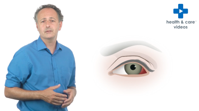 What are Trabeculectomy and Glaucoma Implant surgery? Thumbnail