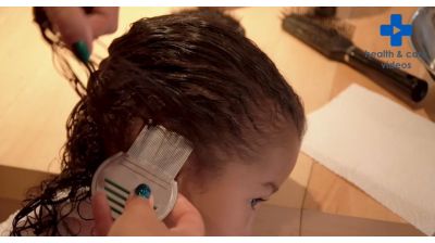 Finding and treating Head Lice Thumbnail