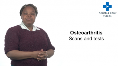 Osteoarthritis - scans and tests Thumbnail