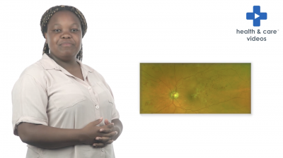 How is Diabetic retinopathy and maculopathy treated? Thumbnail