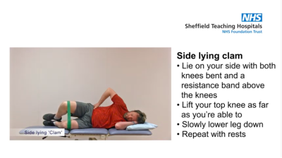 Hip and groin pain management - Side lying exercises Thumbnail