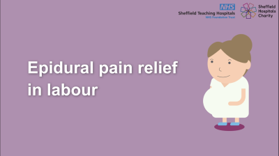Epidural pain relief in labour Thumbnail