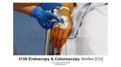 Endoscopy & Colonoscopy - venflon plaster being put on Thumbnail