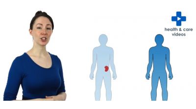 What is a kidney transplant and who can have one? Thumbnail